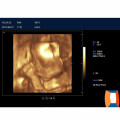 3d / 4D carrinho médico cor doppler &amp; sonography preço da máquina